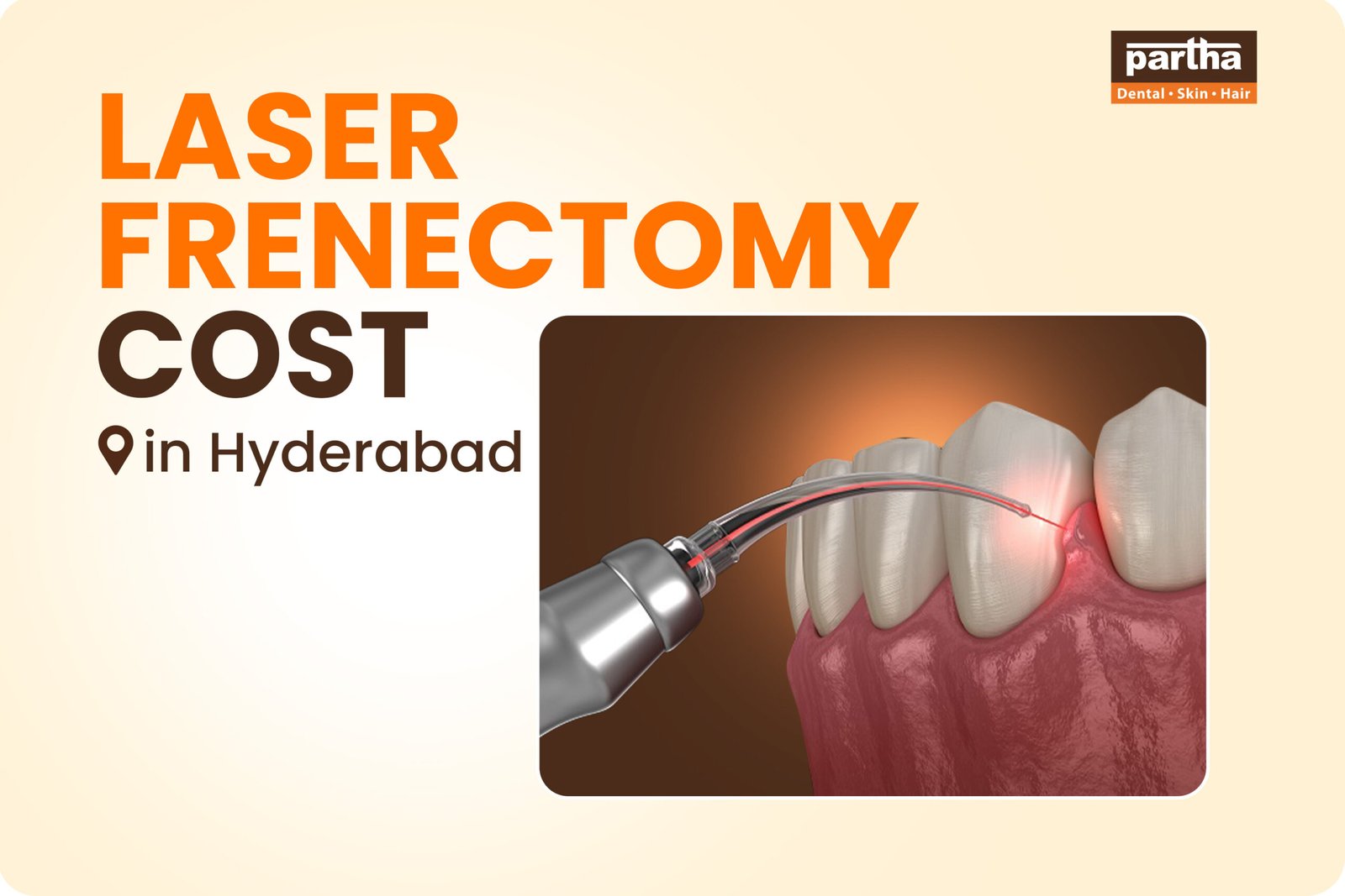 Laser Frenectomy Cost in Hyderabad
