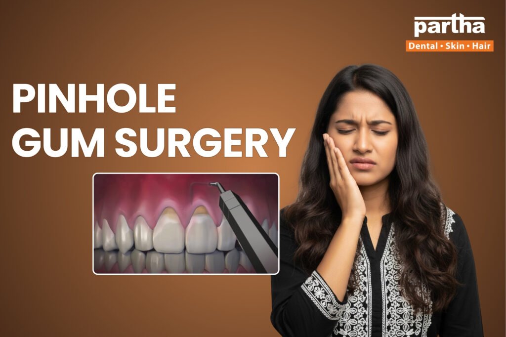 Pinhole Gum Surgery Cost | Minimally Invasive Gum Treatment