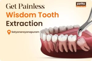 Wisdom Tooth Extraction in Satyanarayanapuram