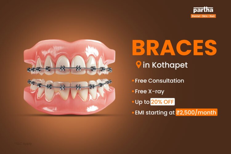 Braces Kothapet