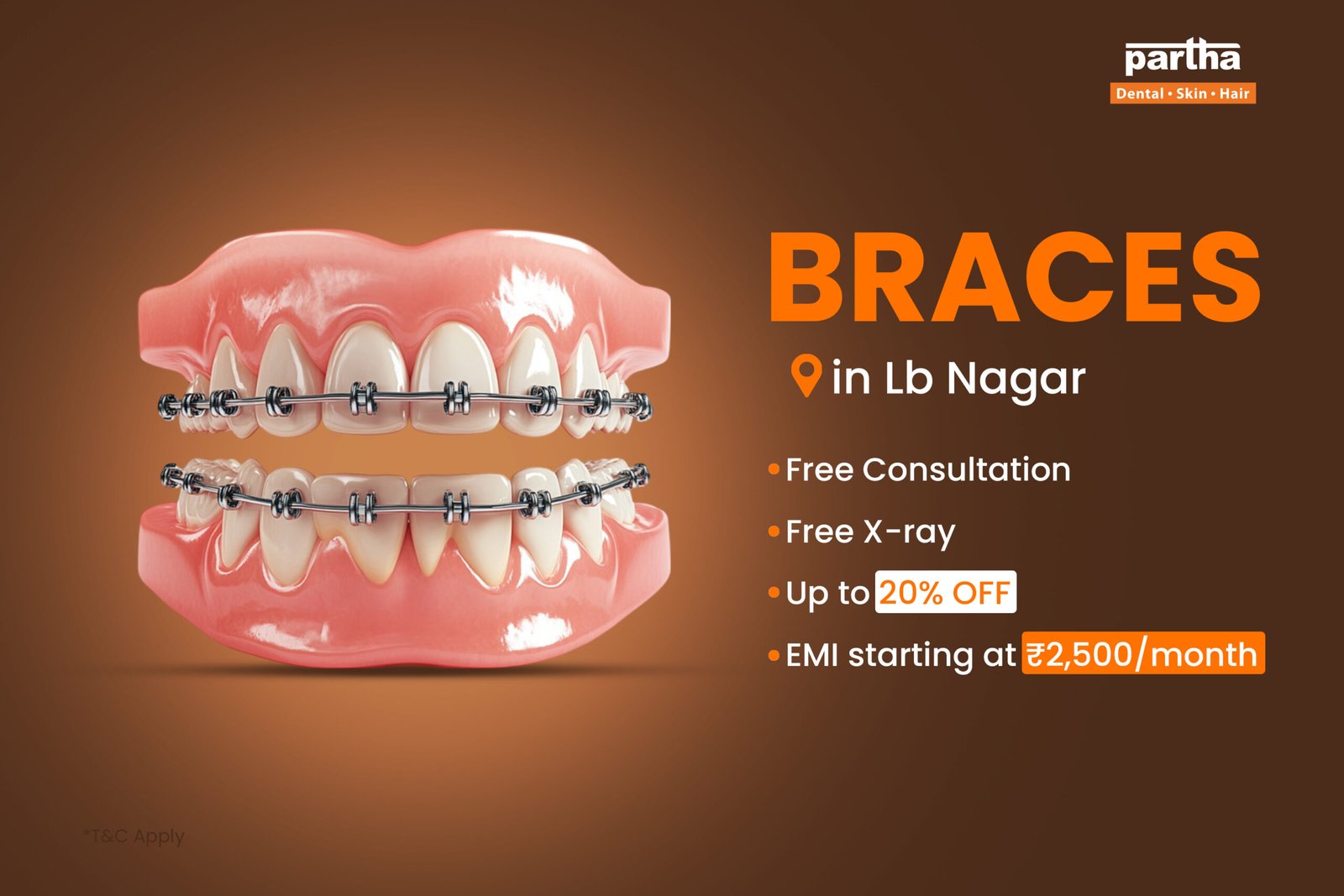 Braces-Lb-Nagar