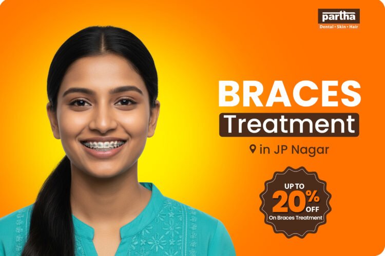 Braces Treatment in JP Nagar