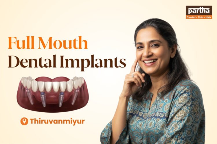 Full Mouth Dental Implants in Thiruvanmiyur