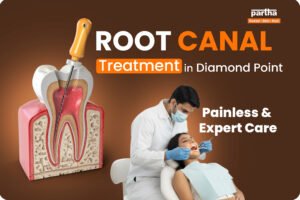 Root-Canal-Treatment-Diamond-point-