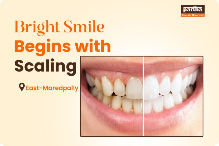 Scaling -East-Maredpally