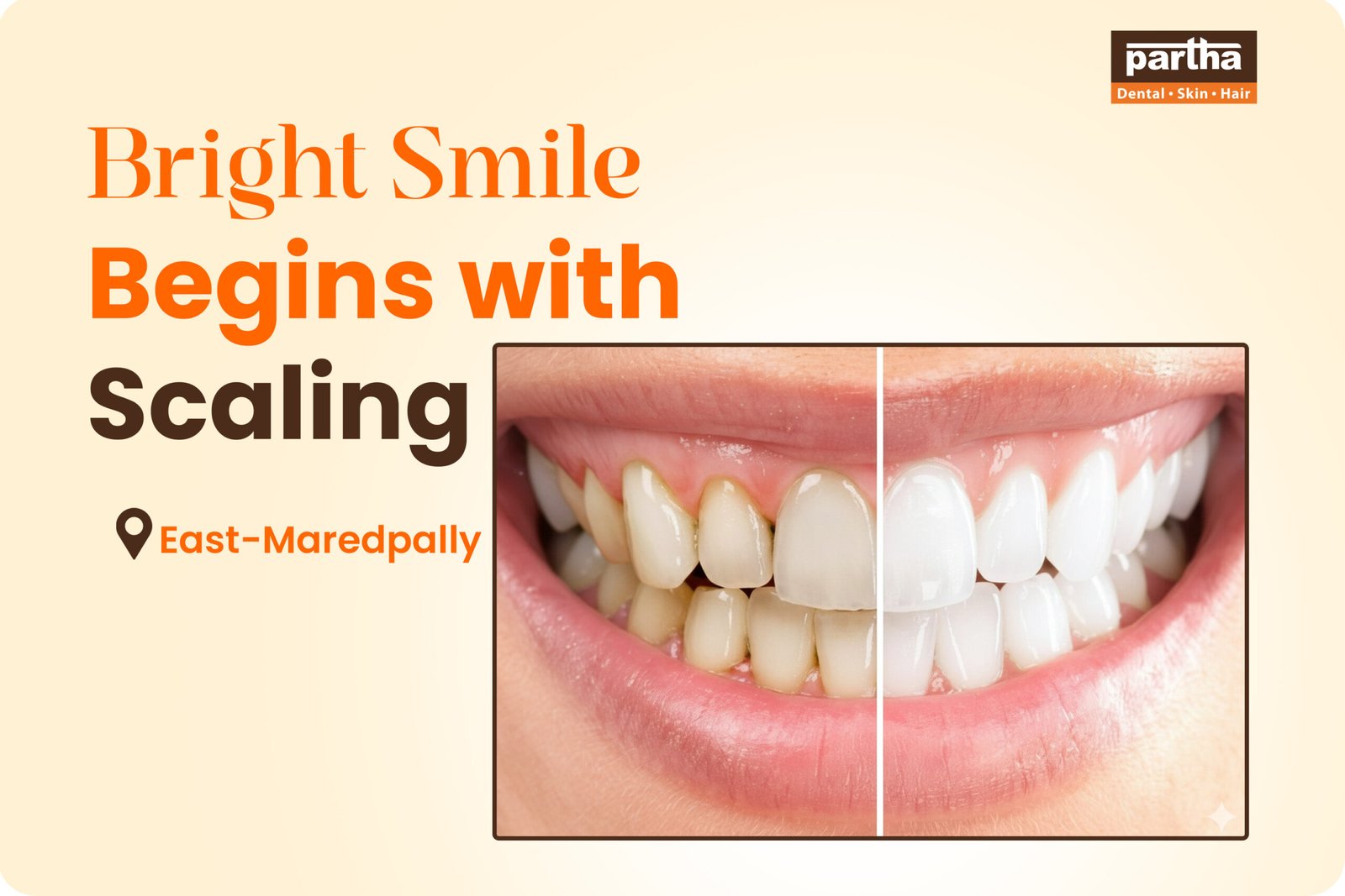 Scaling -East-Maredpally