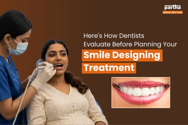 Smile Designing Blog Thumbnail