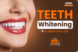 Teeth Whitening in Electronic City