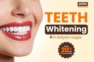 Teeth Whitening Clinic in Kalyan Nagar