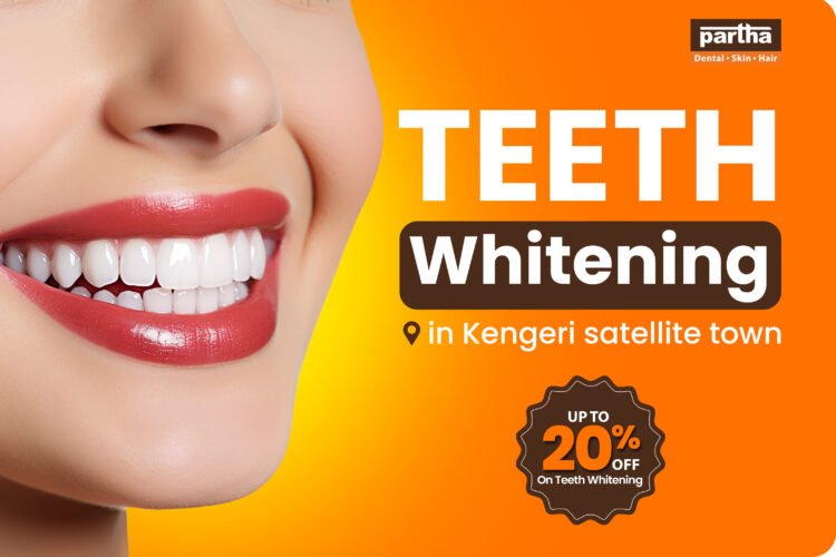 Teeth Whitening Clinic in Kengeri Satellite Town
