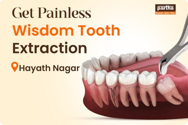 Wisdom Teeth Extarction Hayath Nagar