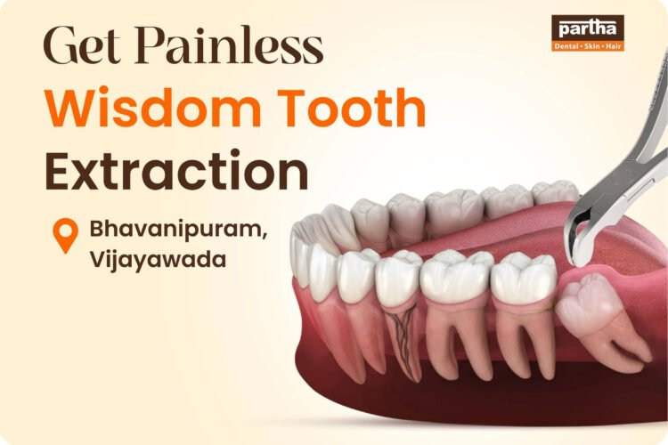 Wisdom Tooth Extraction in Bhavanipuram