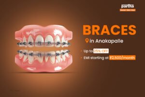 teeth Braces in Anakapalle