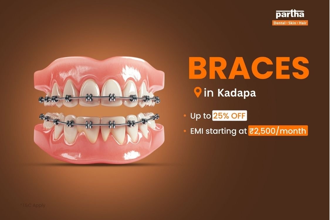 teeth braces in kadapa