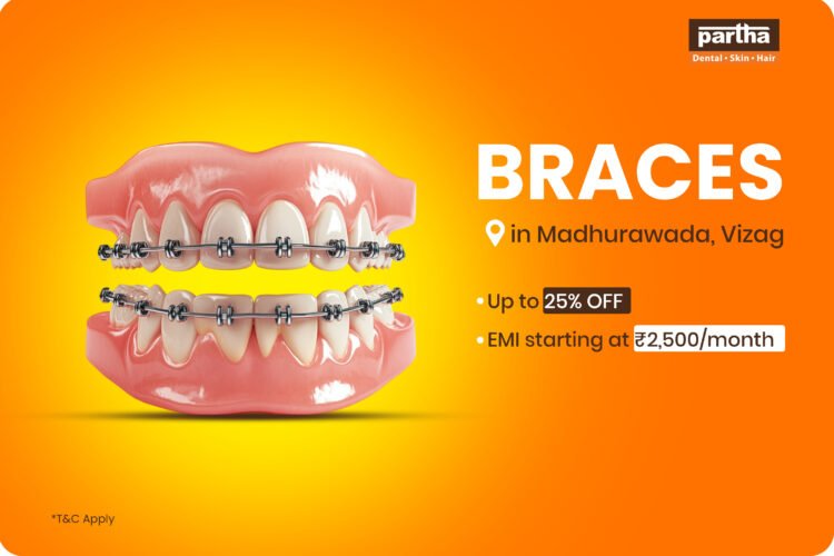 teeth braces in madhurawada