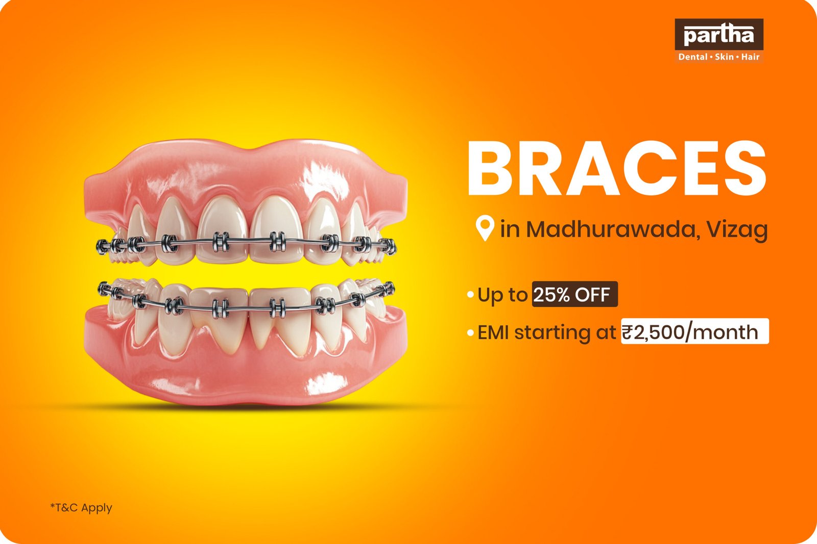 teeth braces in madhurawada