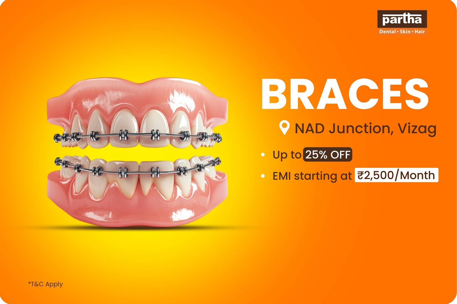 teeth braces in nad junction