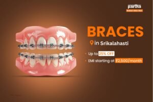 teeth braces in srikalahasti