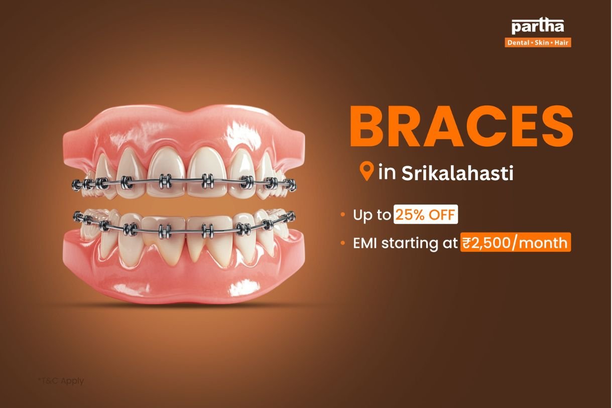 teeth braces in srikalahasti