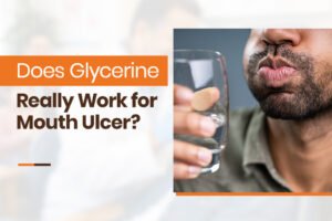 does glycerine really work for mouth ulcer