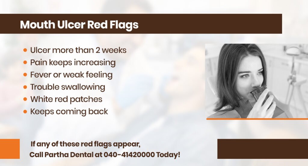 Does Glycerine Really Work for Mouth Ulcer? 3 mouth ulcer red flags