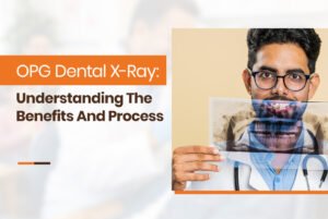 opg dental xray