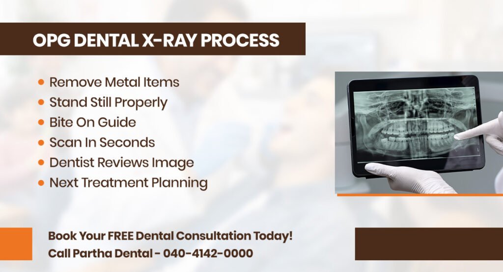 OPG Dental X-Ray: Understanding The Benefits And Process 3 opg dental xray process