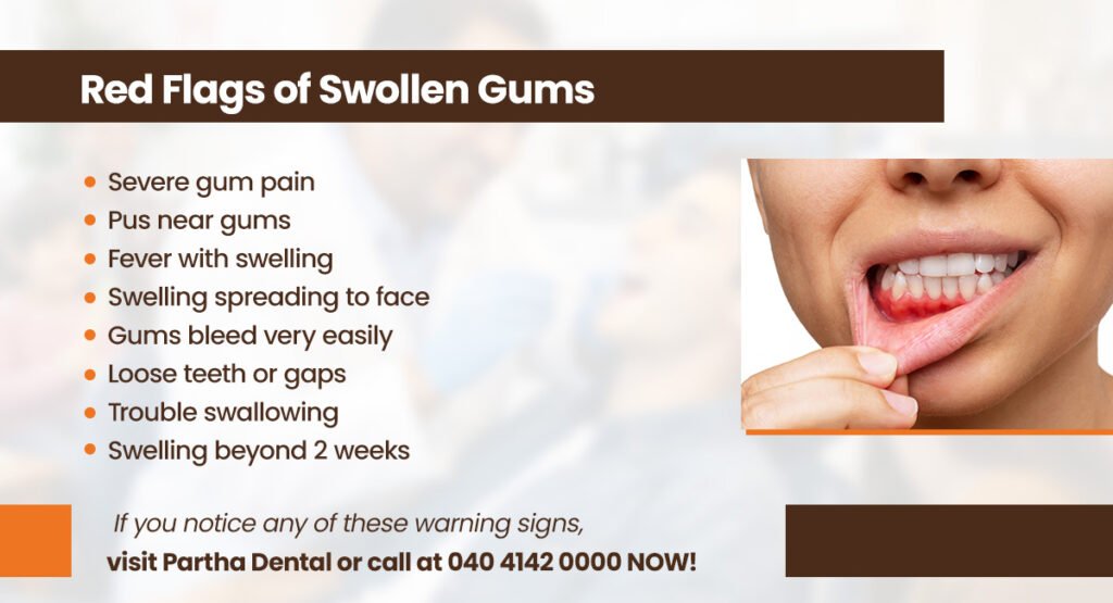 Swollen Gums: Causes, Symptoms, and Treatment 2 red flags of swollen gums