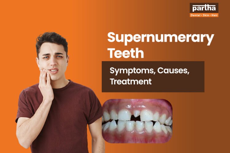 supernumerary teeth