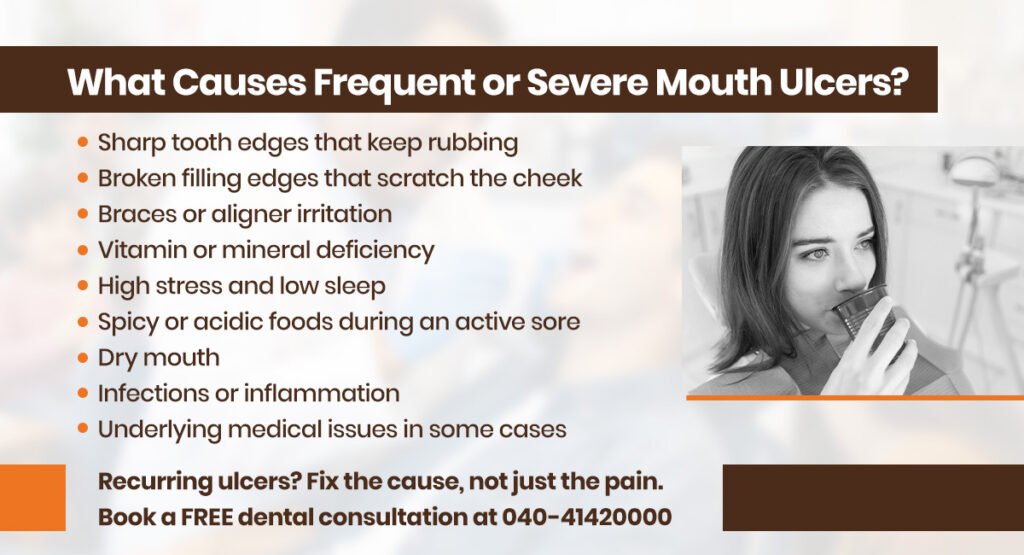 Does Glycerine Really Work for Mouth Ulcer? 2 what causes frequent or severe mouth ulcers