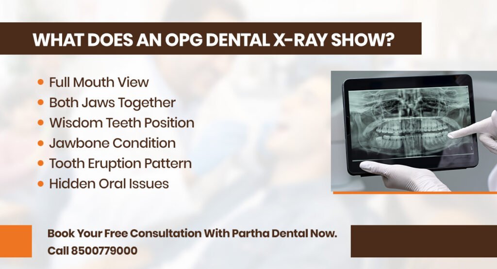 OPG Dental X-Ray: Understanding The Benefits And Process 2 what does an opg dental xray show