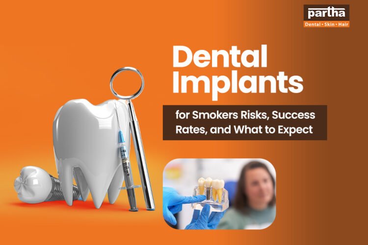 dental implants for smokers