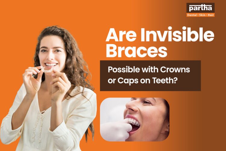 invisible braces possible with crowns or caps