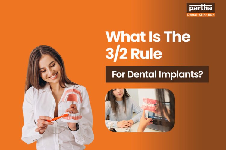 32 rule for dental implants