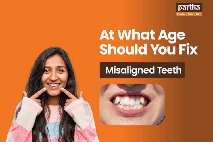 at what age should you fix misaligned teeth