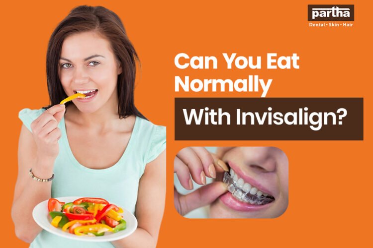 can you eat normally with invisalign