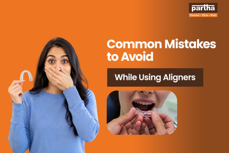 common mistakes to avoid while using aligners