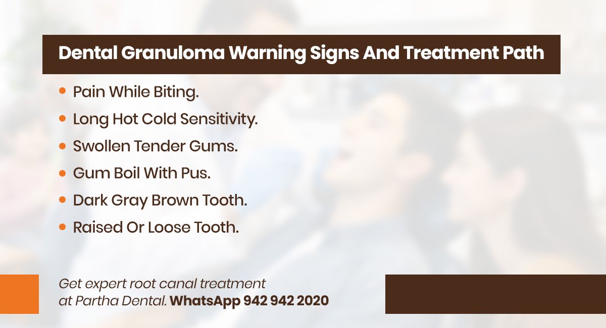 Dental Granuloma: Symptoms, Causes, Treatment 2 dental granuloma warning signs