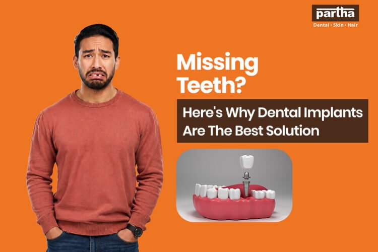 dental implants are the best solution