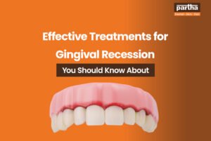 effective treatments for gingival recession