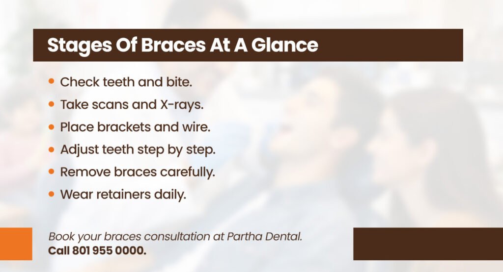 5 Stages of Braces: Here's What to Expect 2 stages of braces at a glance