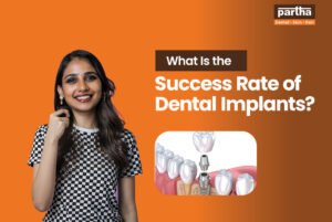 success rate of dental implant