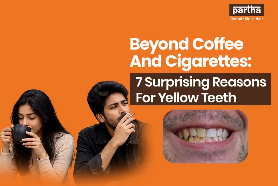 7 Reasons For Yellow Teeth & Best Treatment Options