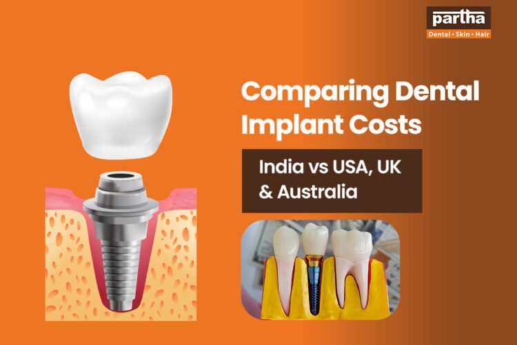 comparing dental implant costs