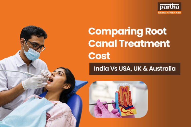 comparing root canal treatment cost