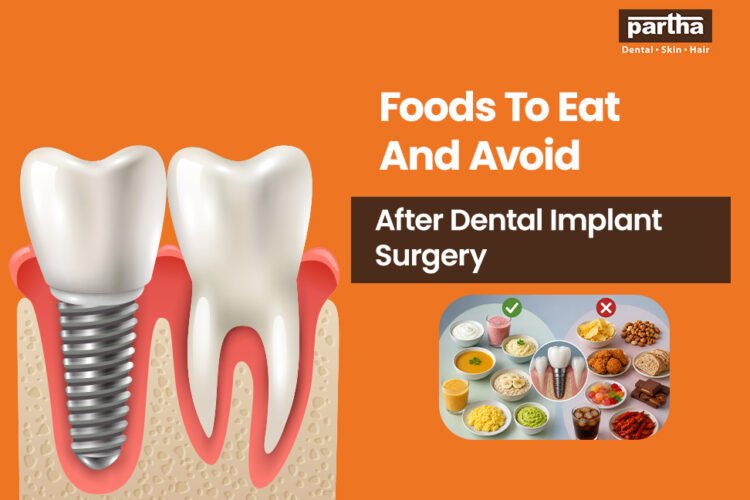 foods to eat and avoid after dental implant surgery