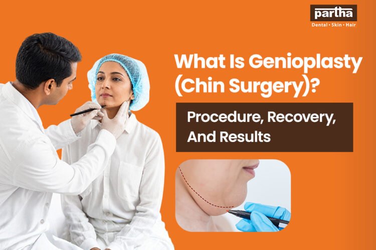 what is genioplasty