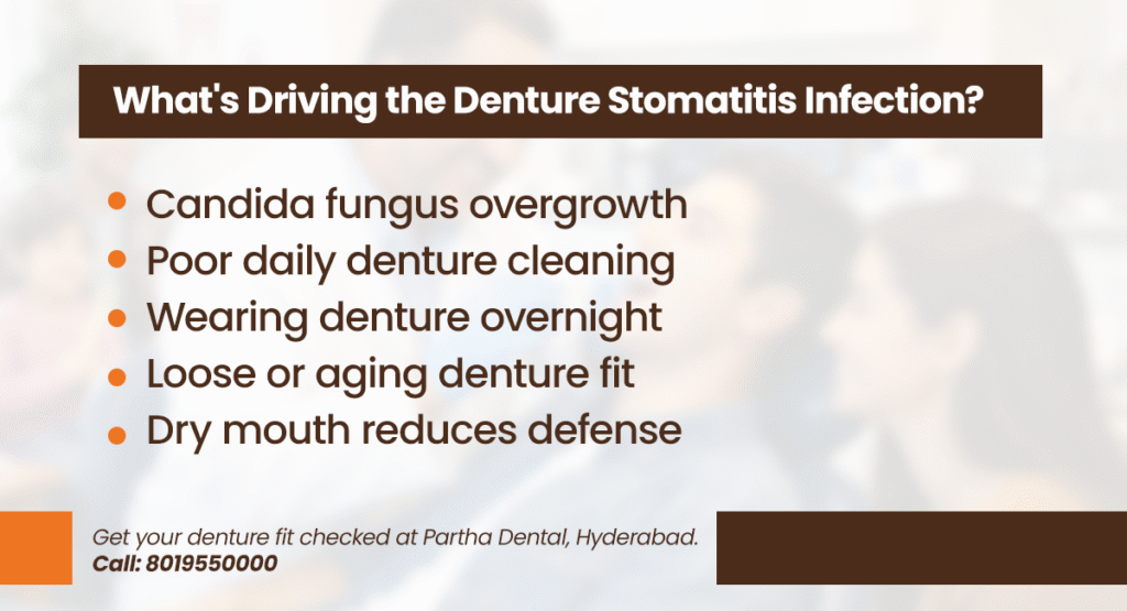 Denture Stomatitis – Causes, Symptoms, Diagnosis, Treatment 2 whats driving the denture stomatitis infection