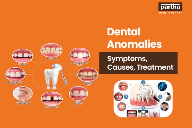dental anomalies