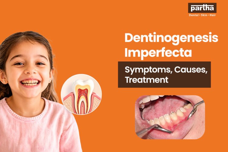 dentinogenesis imperfecta treatments